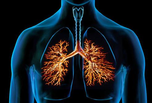 Čo je obštrukčná bronchitída?